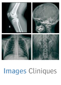 Images cliniques