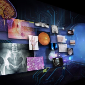 Agfa HealthCare